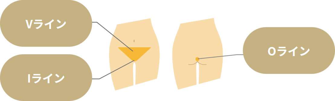リゼクリニックのVIO脱毛範囲