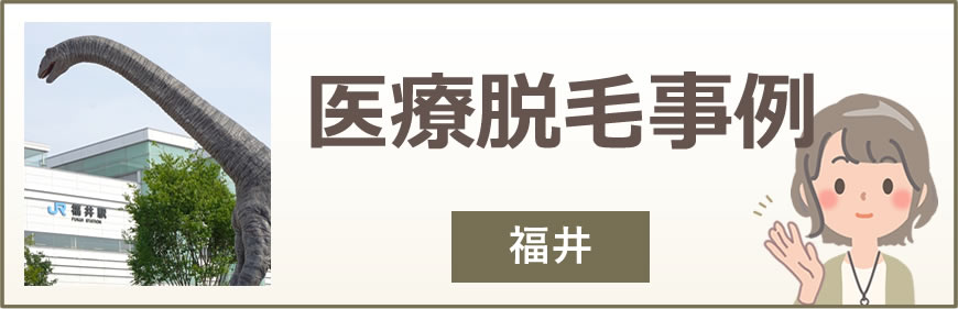 福井の医療脱毛事例