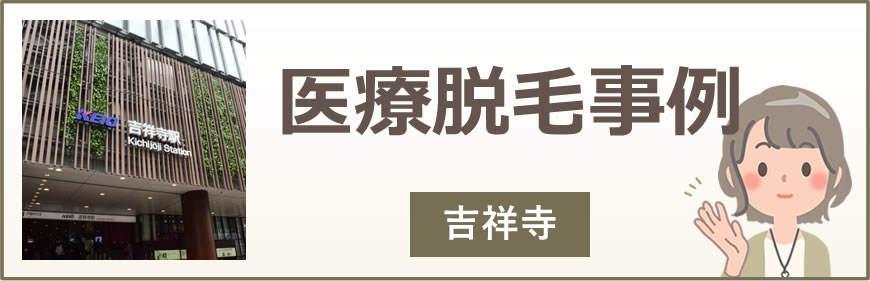 吉祥寺の医療脱毛事例