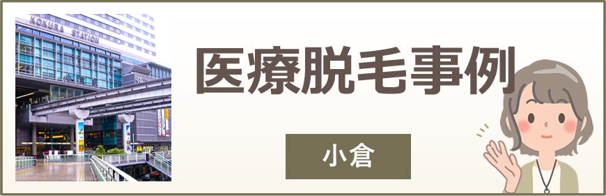 小倉の医療脱毛事例