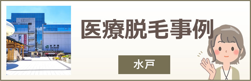 水戸の医療脱毛事例