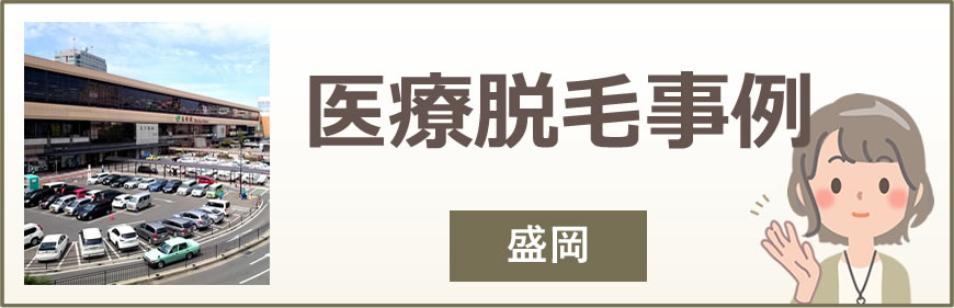 盛岡の医療脱毛事例