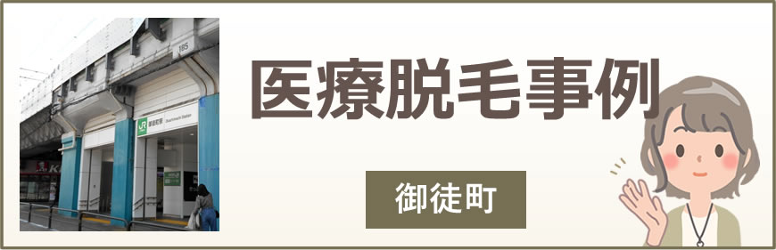 御徒町の医療脱毛事例