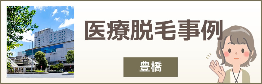 豊橋の医療脱毛事例