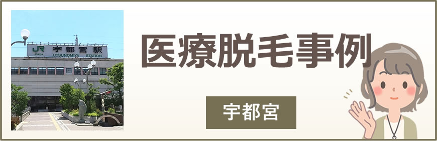 宇都宮の医療脱毛事例